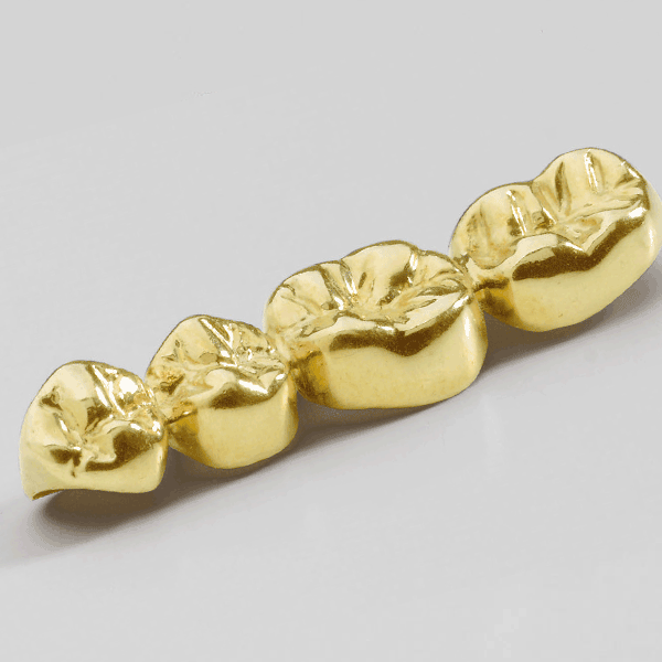 How Much Is Your Dental Gold Really Worth